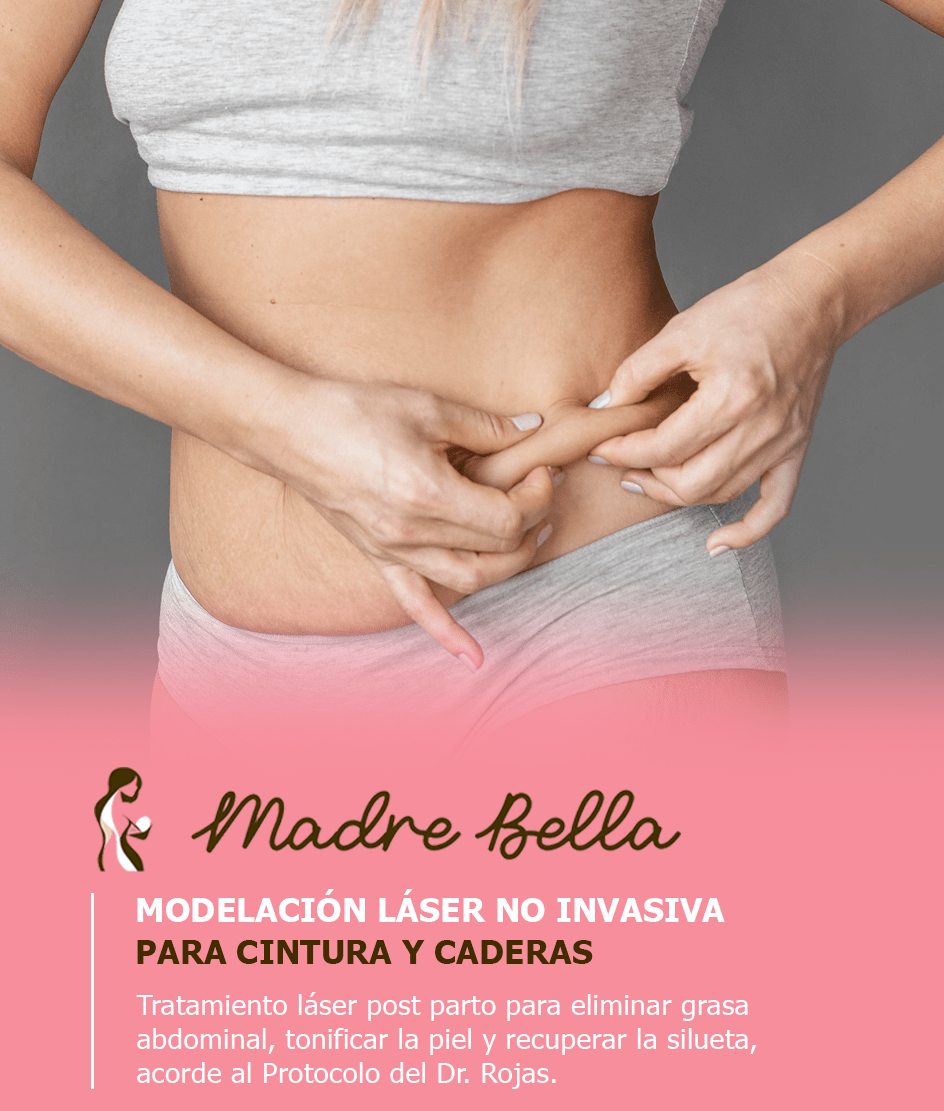 Tratamiento láser para cintura y caderas - Recuperación post parto sin cirugía | Madre Bella